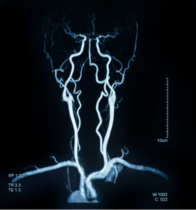 Picture of Head & Neck Observership